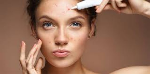 The Isotroin 20mg Acne Solution