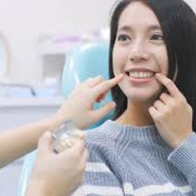 Invisalign Redmond